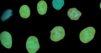 Imaris 11 transforms image analysis